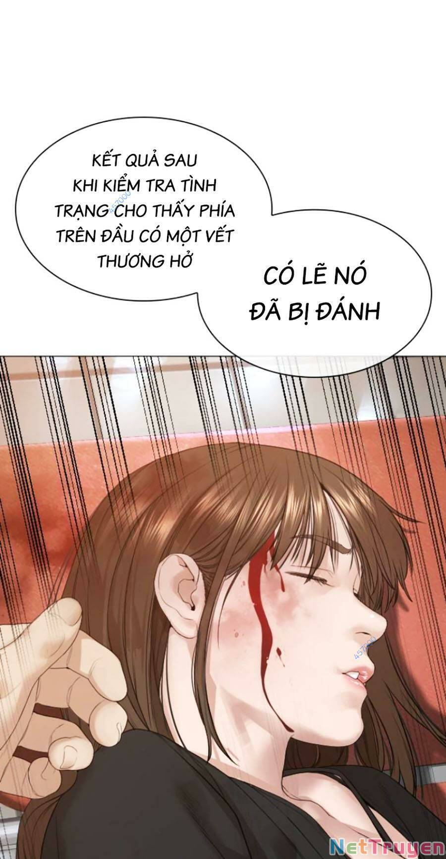 Cách Chiến Thắng Trận Đấu Chap 174 - Next Chap 175