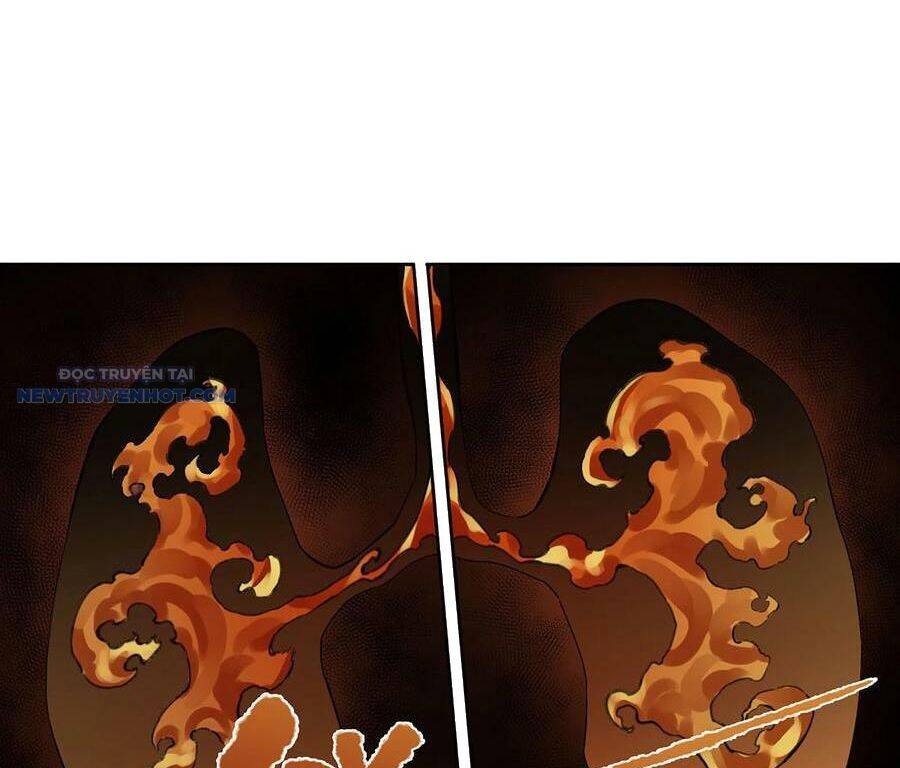 Truyền Võ Chap 317 - Next Chap 318
